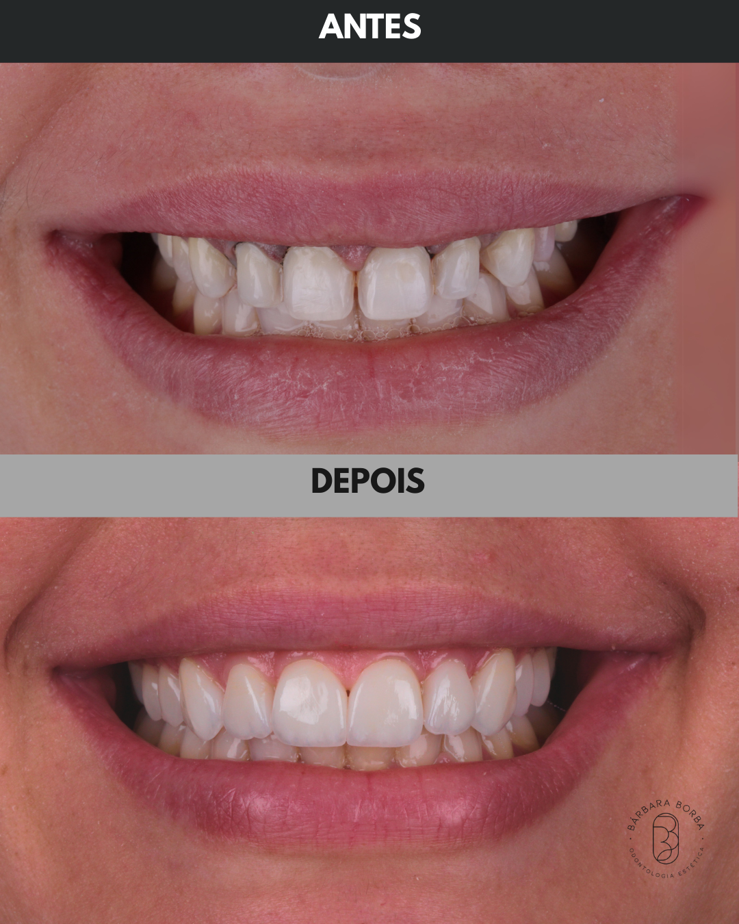 Antes e Depois - 03